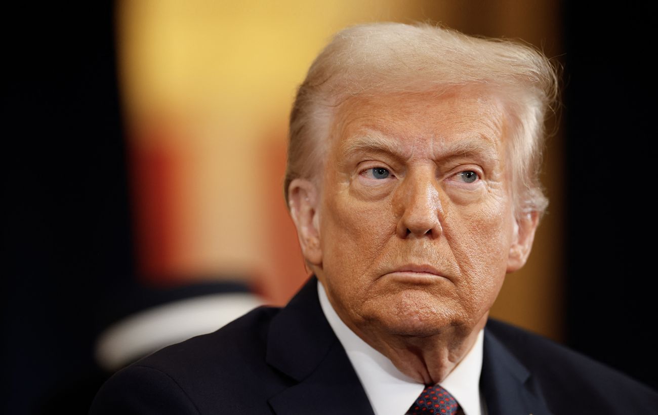 У Трампа виявили проблеми з венами
